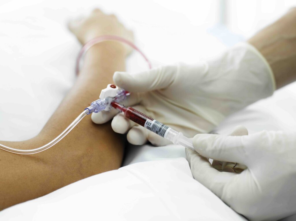 より正確で迅速な血液ガス検査を可能にする動脈血サンプラー